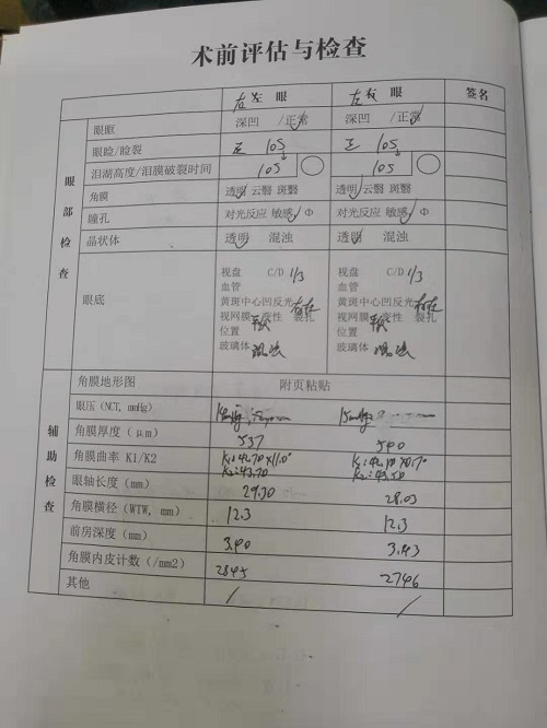 近视手术分享