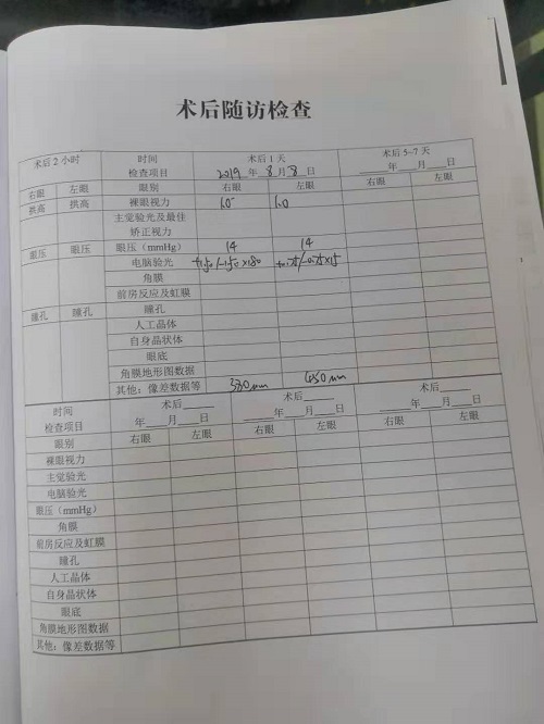 近视手术分享